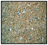 Immunohistochemistry (Formalin/PFA-fixed paraffin-embedded sections) - Anti-MST3 antibody [EP1468Y] (AB51137)