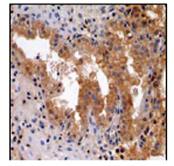 Immunohistochemistry (Formalin/PFA-fixed paraffin-embedded sections) - Anti-MST4 antibody [EP1864Y] (AB52491)