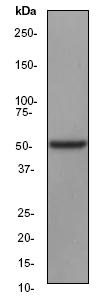 Western blot - Anti-MST4 antibody [EP1864Y] (AB52491)