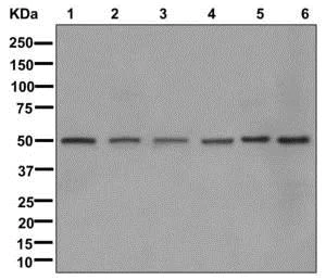 Western blot - Anti-MST4 antibody [EPR12766] - BSA and Azide free (AB249938)