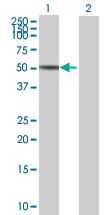 Western blot - MST4 overexpression 293T lysate (whole cell) (AB94208)