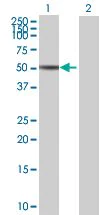 Western blot - MST4 overexpression 293T lysate (whole cell) (AB94208)
