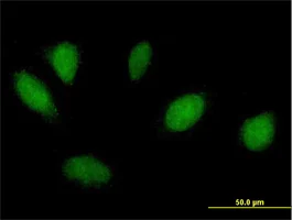 Immunocytochemistry/ Immunofluorescence - Anti-MSX1 antibody (AB168745)