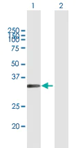 Western blot - Anti-MSX1 antibody (AB168745)