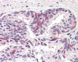 Immunohistochemistry (Formalin/PFA-fixed paraffin-embedded sections) - Anti-MSX1 antibody (AB93287)