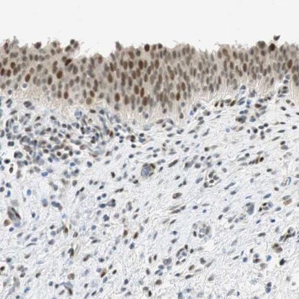 Immunohistochemistry (Formalin/PFA-fixed paraffin-embedded sections) - Anti-Msx2/Hox8 antibody (AB223692)