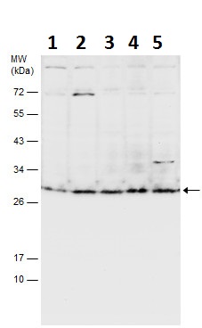 Western blot - Anti-Msx2/Hox8 antibody (AB227720), expandable thumbnail