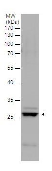 Western blot - Anti-Msx2/Hox8 antibody (AB227720), expandable thumbnail