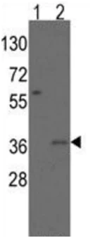 Western blot - Anti-Msx2/Hox8 antibody - N-terminal (AB190070)