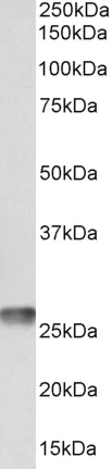 Western blot - Anti-MT-ATP6 antibody - C-terminal (AB190287)