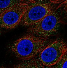 Immunocytochemistry/ Immunofluorescence - Anti-MT-ND3 antibody (AB204977)