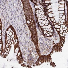 Immunohistochemistry (Formalin/PFA-fixed paraffin-embedded sections) - Anti-MT-ND3 antibody (AB204977)