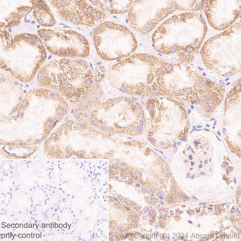 Immunohistochemistry (Formalin/PFA-fixed paraffin-embedded sections) - Anti-MT-ND4 antibody [EPR28273-38] (AB324743)