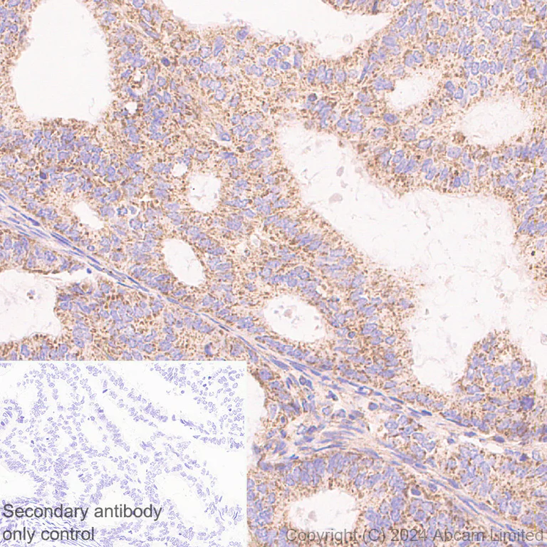Immunohistochemistry (Formalin/PFA-fixed paraffin-embedded sections) - Anti-MT-ND4 antibody [EPR28273-38] (AB324743)
