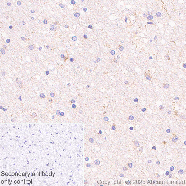 Immunohistochemistry (Formalin/PFA-fixed paraffin-embedded sections) - Anti-MT-ND4 antibody [EPR28273-38] (AB324743)