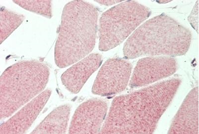 Immunohistochemistry (Formalin/PFA-fixed paraffin-embedded sections) - Anti-MT-ND5 antibody (AB230509)