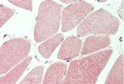 Immunohistochemistry (Formalin/PFA-fixed paraffin-embedded sections) - Anti-MT-ND5 antibody (AB230509)