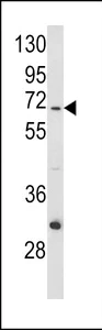 Western blot - Anti-MT-ND5 antibody (AB230509)