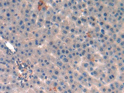 Immunohistochemistry (Formalin/PFA-fixed paraffin-embedded sections) - Anti-MT-ND5 antibody (AB233100)