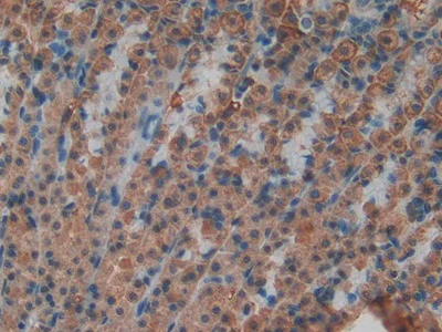 Immunohistochemistry (Formalin/PFA-fixed paraffin-embedded sections) - Anti-MT-ND5 antibody (AB233100)