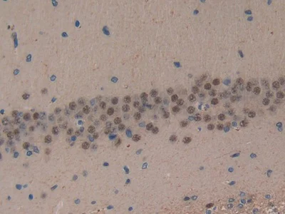 Immunohistochemistry (Formalin/PFA-fixed paraffin-embedded sections) - Anti-MT-ND5 antibody (AB233100)