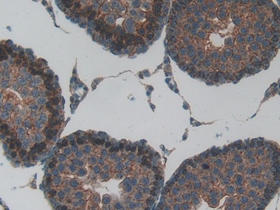 Immunohistochemistry (Formalin/PFA-fixed paraffin-embedded sections) - Anti-MT-ND5 antibody (AB233100)
