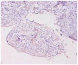 Immunohistochemistry (Formalin/PFA-fixed paraffin-embedded sections) - Anti-MT1E antibody (AB193618)