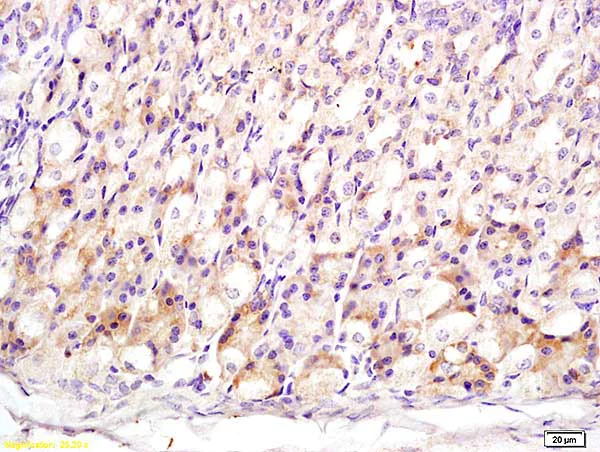 Immunohistochemistry (Formalin/PFA-fixed paraffin-embedded sections) - Anti-MT3 antibody (AB214314)