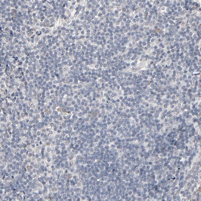Immunohistochemistry (Formalin/PFA-fixed paraffin-embedded sections) - Anti-MT3 antibody (AB224060), expandable thumbnail