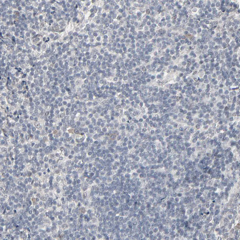 Immunohistochemistry (Formalin/PFA-fixed paraffin-embedded sections) - Anti-MT3 antibody (AB224060)