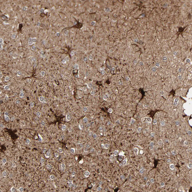 Immunohistochemistry (Formalin/PFA-fixed paraffin-embedded sections) - Anti-MT3 antibody (AB224060)
