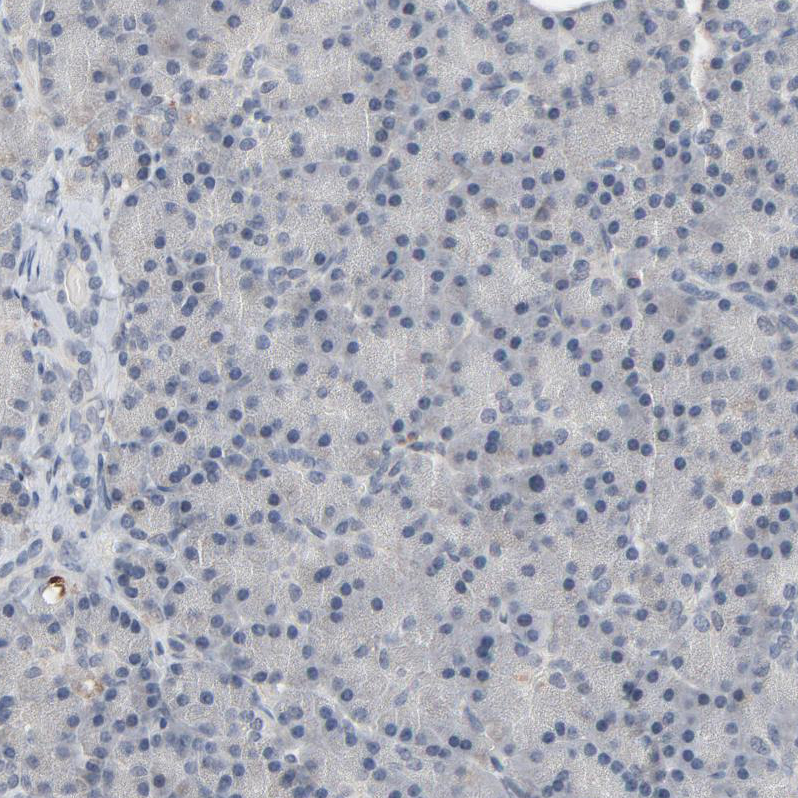 Immunohistochemistry (Formalin/PFA-fixed paraffin-embedded sections) - Anti-MT3 antibody (AB224060), expandable thumbnail