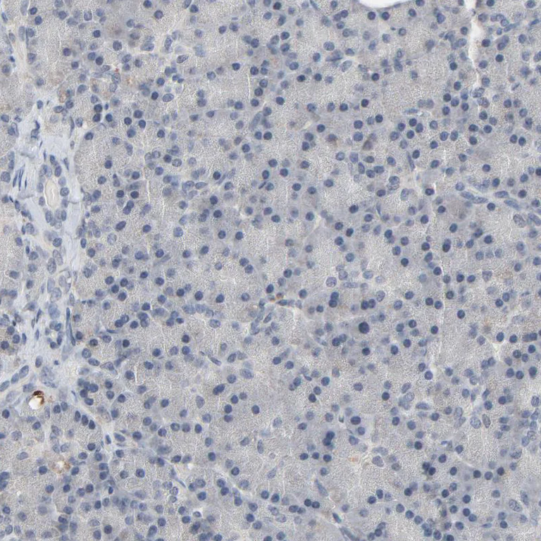 Immunohistochemistry (Formalin/PFA-fixed paraffin-embedded sections) - Anti-MT3 antibody (AB224060)