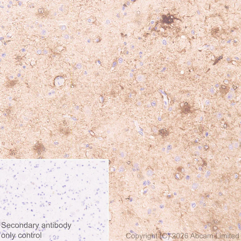Immunohistochemistry (Formalin/PFA-fixed paraffin-embedded sections) - Anti-MT3 antibody [EPR27532-64] (AB327350)