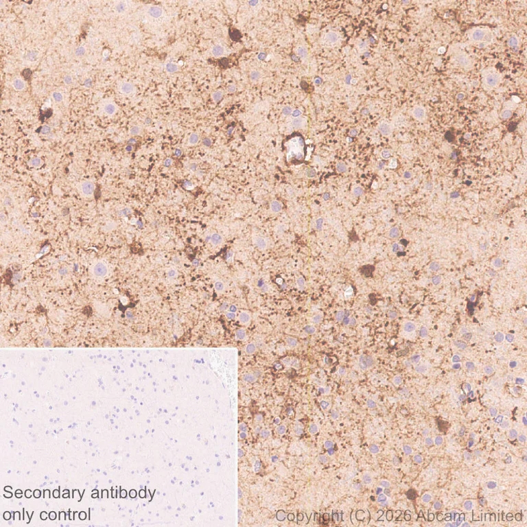 Immunohistochemistry (Formalin/PFA-fixed paraffin-embedded sections) - Anti-MT3 antibody [EPR27532-64] (AB327350)
