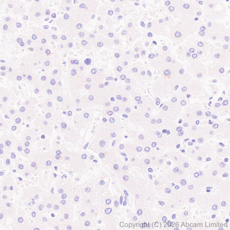 Immunohistochemistry (Formalin/PFA-fixed paraffin-embedded sections) - Anti-MT3 antibody [EPR27532-64] (AB327350)