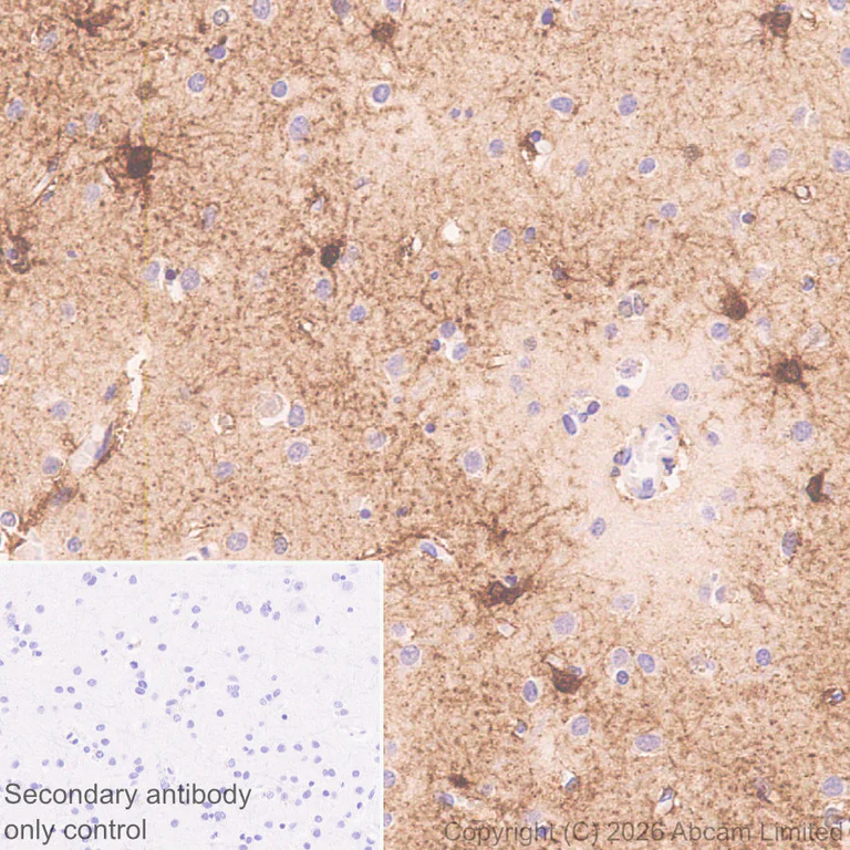 Immunohistochemistry (Formalin/PFA-fixed paraffin-embedded sections) - Anti-MT3 antibody [EPR27532-64] - BSA and Azide free (AB327362)