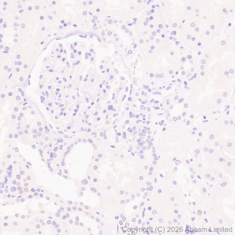 Immunohistochemistry (Formalin/PFA-fixed paraffin-embedded sections) - Anti-MT3 antibody [EPR27532-64] - BSA and Azide free (AB327362)