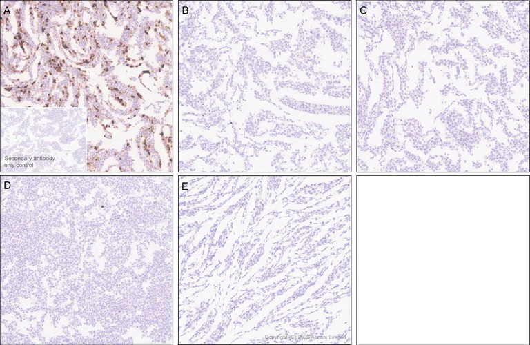 Immunohistochemistry (Formalin/PFA-fixed paraffin-embedded sections) - Anti-MT3 antibody [EPR27532-64] - BSA and Azide free (AB327362)