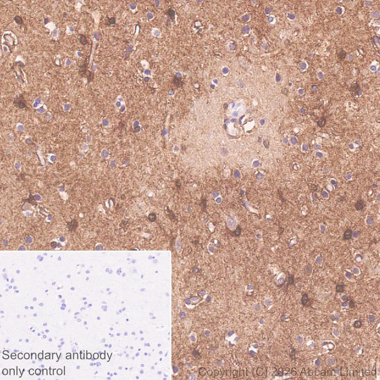 Immunohistochemistry (Formalin/PFA-fixed paraffin-embedded sections) - Anti-MT3 antibody [EPR27532-88] (AB327349)