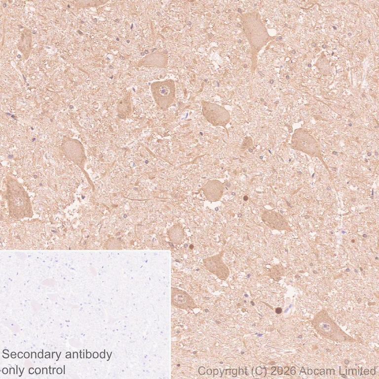 Immunohistochemistry (Formalin/PFA-fixed paraffin-embedded sections) - Anti-MT3 antibody [EPR27532-88] (AB327349)