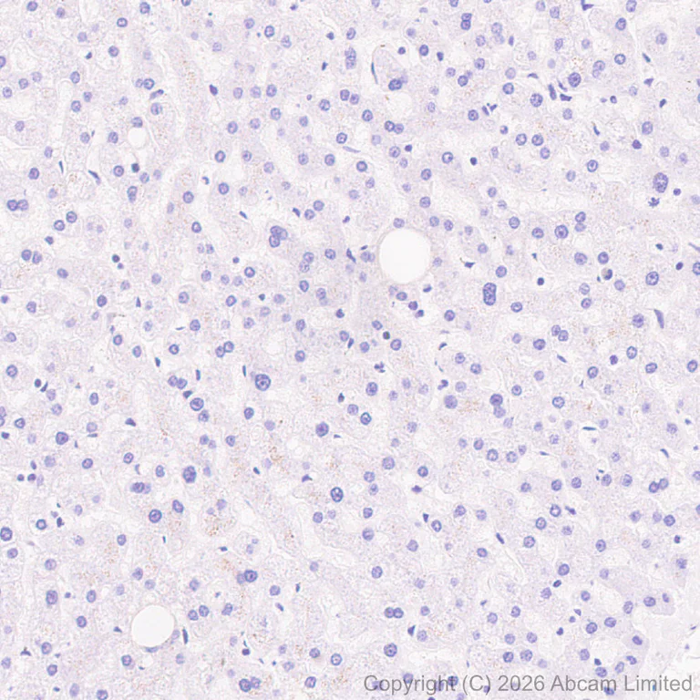 Immunohistochemistry (Formalin/PFA-fixed paraffin-embedded sections) - Anti-MT3 antibody [EPR27532-88] (AB327349)