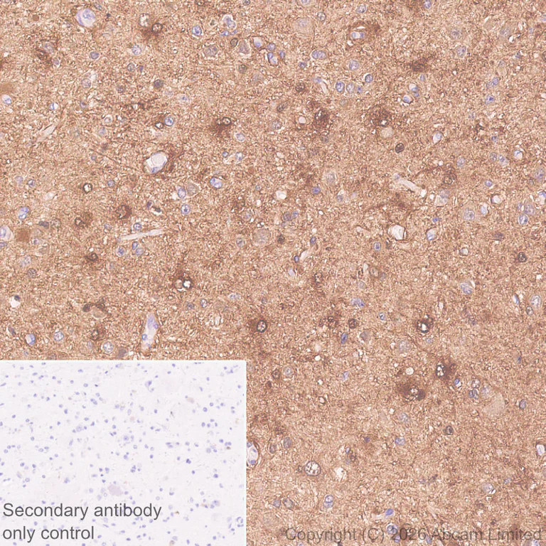 Immunohistochemistry (Formalin/PFA-fixed paraffin-embedded sections) - Anti-MT3 antibody [EPR27532-88] - BSA and Azide free (AB327361)