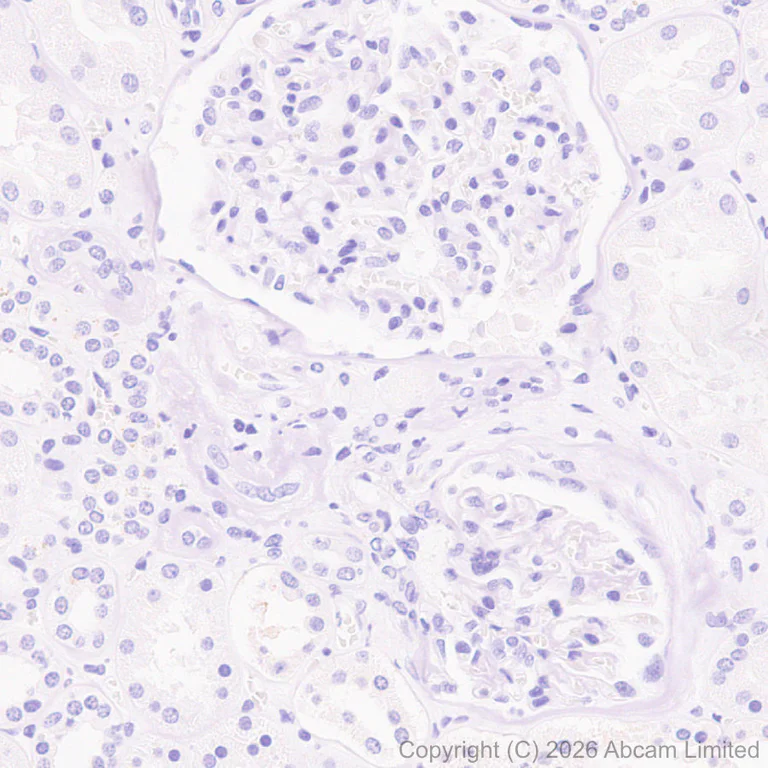 Immunohistochemistry (Formalin/PFA-fixed paraffin-embedded sections) - Anti-MT3 antibody [EPR27532-88] - BSA and Azide free (AB327361)