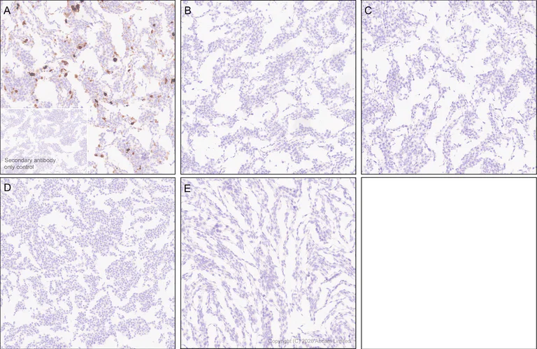 Immunohistochemistry (Formalin/PFA-fixed paraffin-embedded sections) - Anti-MT3 antibody [EPR27532-88] - BSA and Azide free (AB327361)