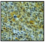 Anti-MT4-MMP antibody [EP1270Y]