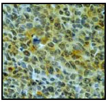 Immunohistochemistry (Formalin/PFA-fixed paraffin-embedded sections) - Anti-MT4-MMP antibody [EP1270Y] - BSA and Azide free (AB247310)