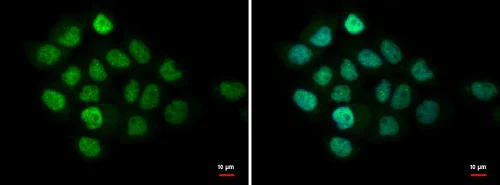 Immunocytochemistry/ Immunofluorescence - Anti-MTA1 antibody (AB226960)