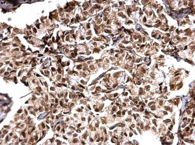 Immunohistochemistry (Formalin/PFA-fixed paraffin-embedded sections) - Anti-MTA1 antibody (AB226960)