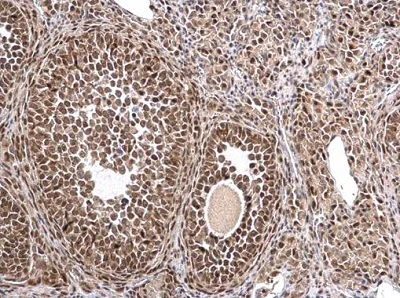 Immunohistochemistry (Formalin/PFA-fixed paraffin-embedded sections) - Anti-MTA1 antibody (AB226960)